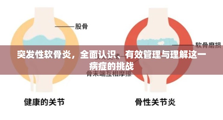 突发性软骨炎,全面认识、有效管理与理解这一病症的挑战
