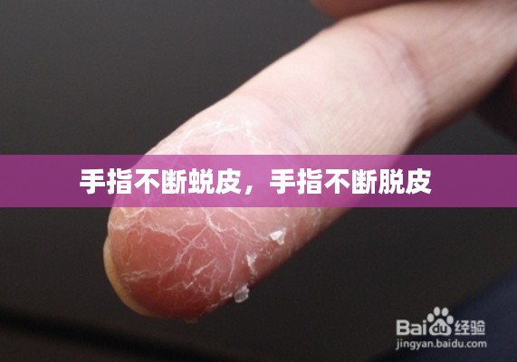 铺张扬厉 第2页