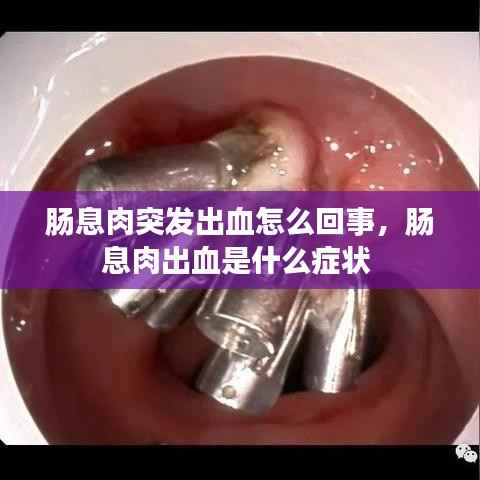 肠息肉突发出血怎么回事,肠息肉出血是什么症状