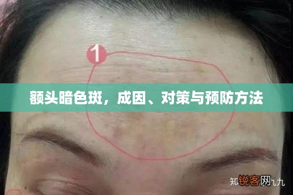 额头暗色斑,成因、对策与预防方法