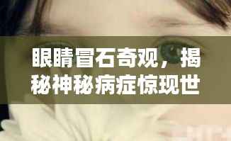 眼睛冒石奇观,揭秘神秘病症惊现世间!