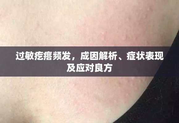 过敏疙瘩频发,成因解析、症状表现及应对良方